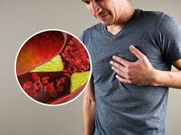 رژیم غذایی مناسب برای کلسترول بالا | چه بخوریم تا کلسترول پایین بیاید؟